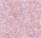 RBBP8 Antibody
